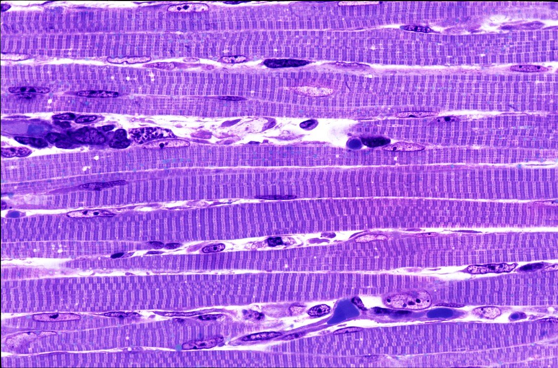 Skeletal muscle,light micrograph