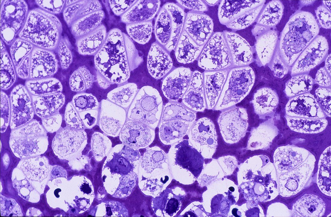 Chondrocytes,light micrograph