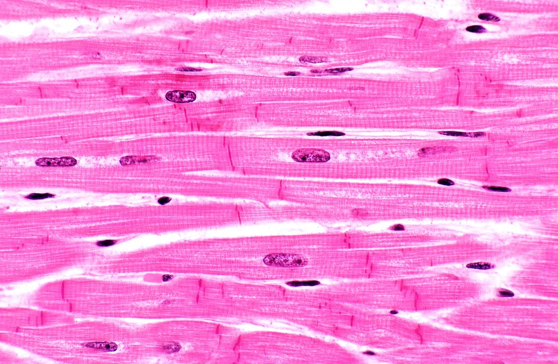 Heart muscle,light micrograph