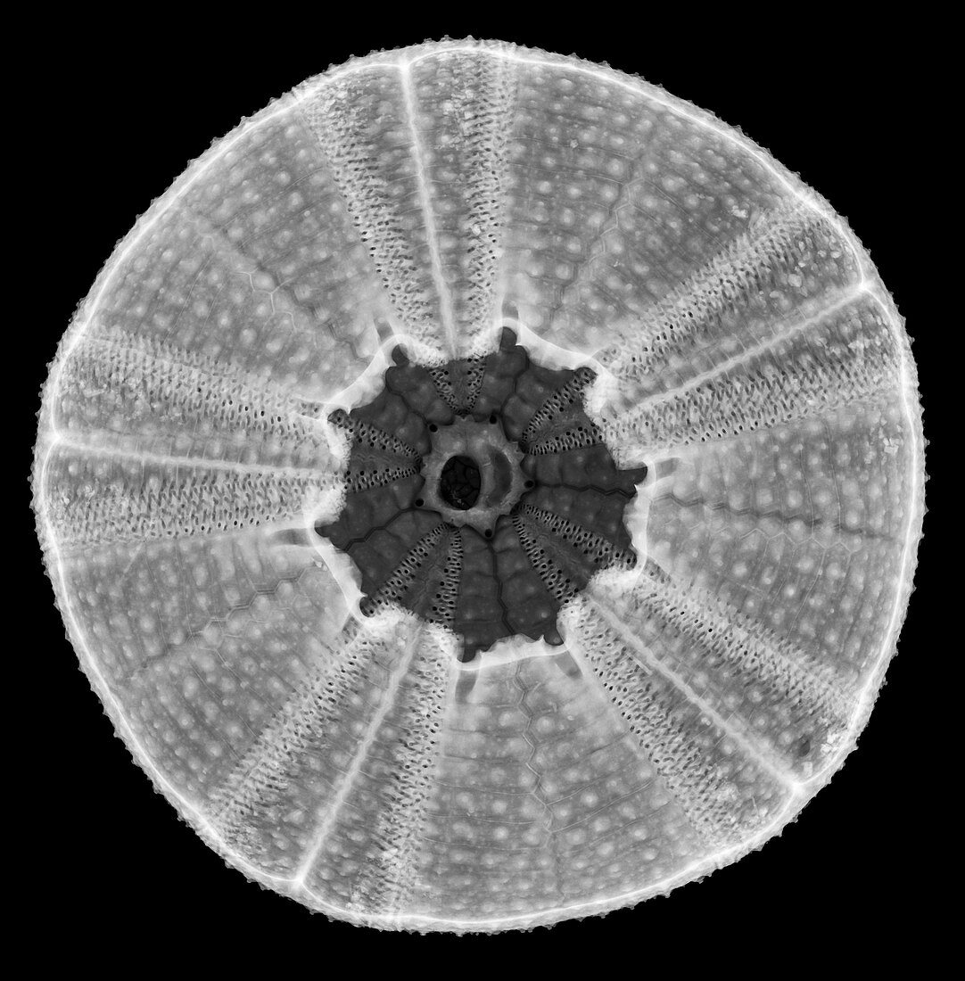 Sea urchin,X-ray