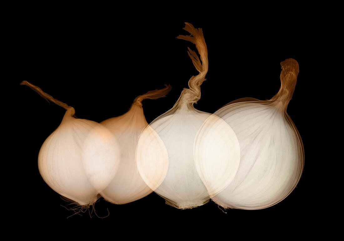 Onions (Allium cepa),X-ray
