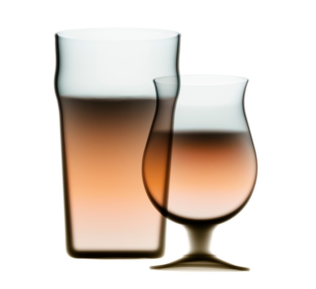 Drinks in glasses,X-ray