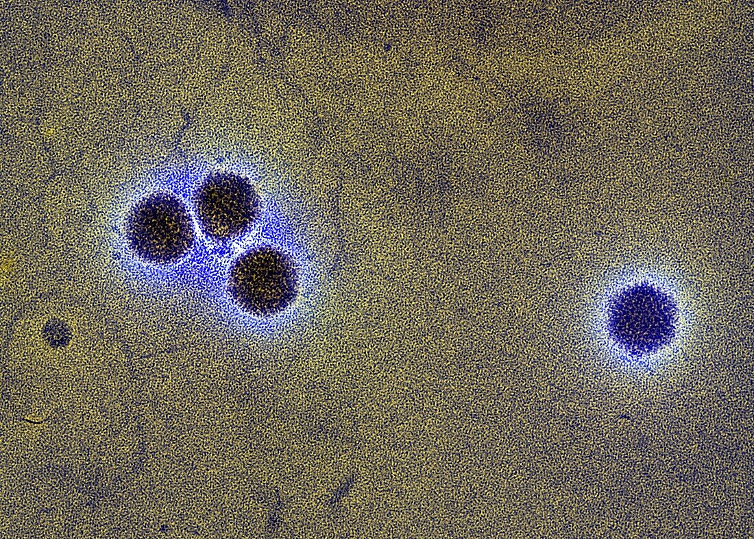 Adenovirus particles,TEM
