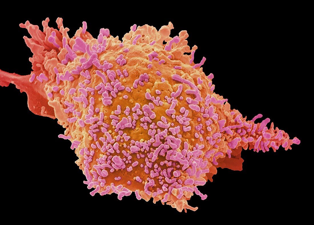 Fibrosarcoma cell,SEM