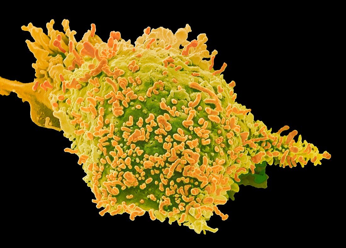 Fibrosarcoma cell,SEM