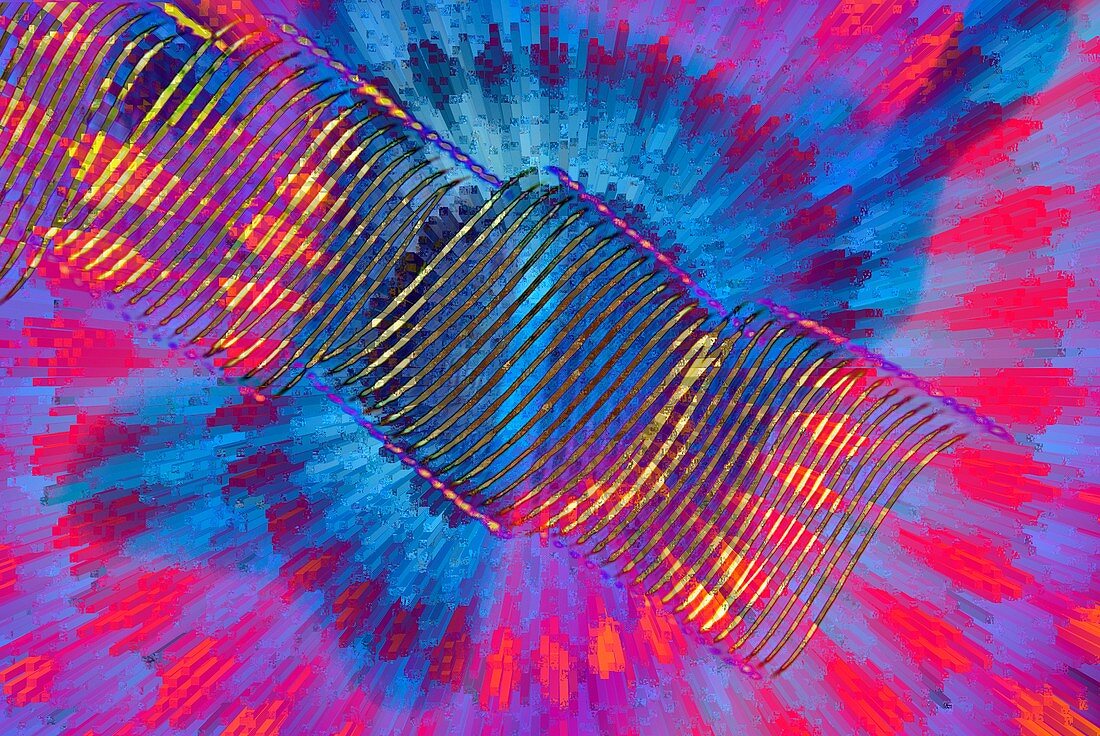 Spiral vessel,polarised light micrograph