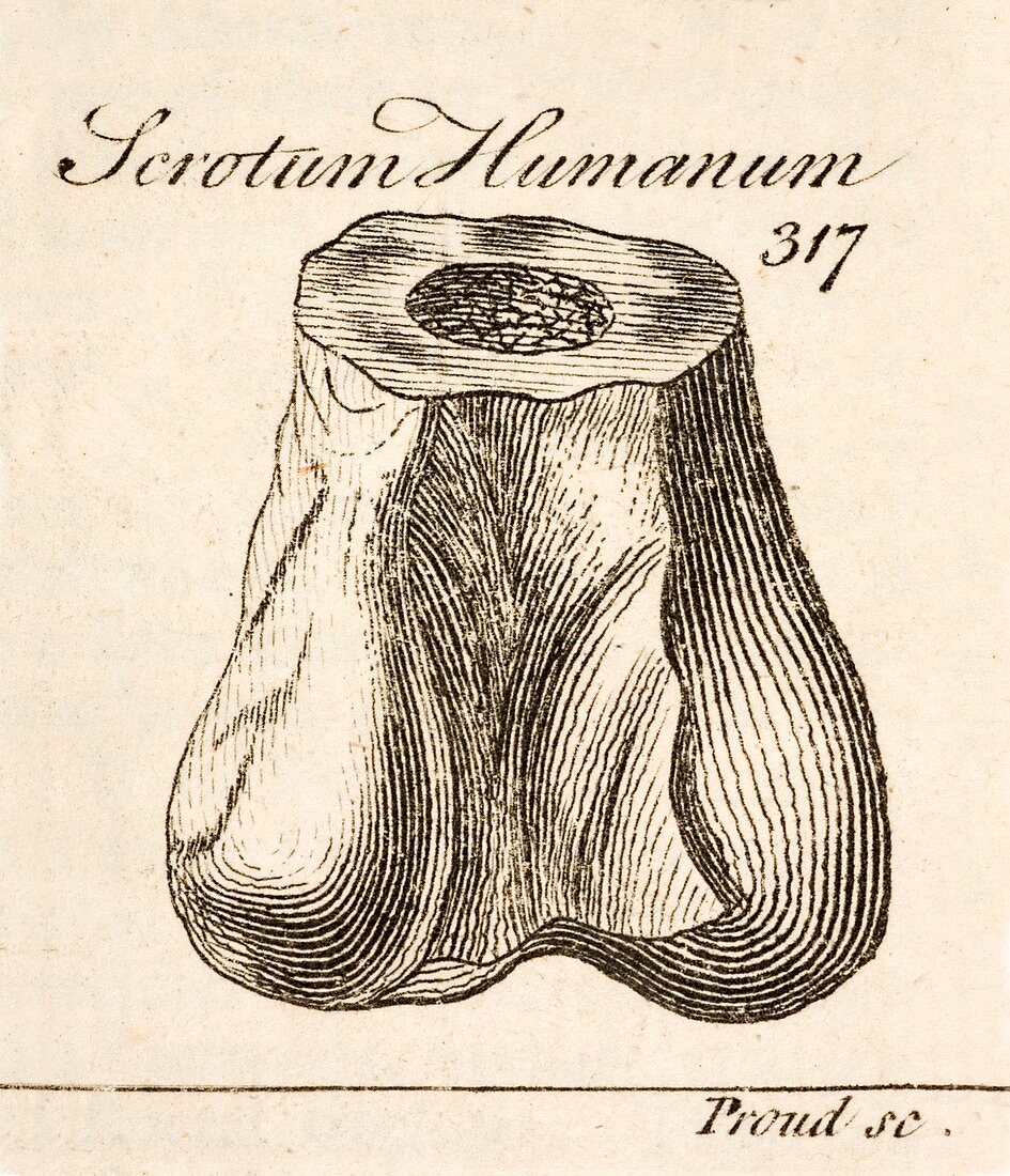 1763 Dinosaur bone misidentified scrotum