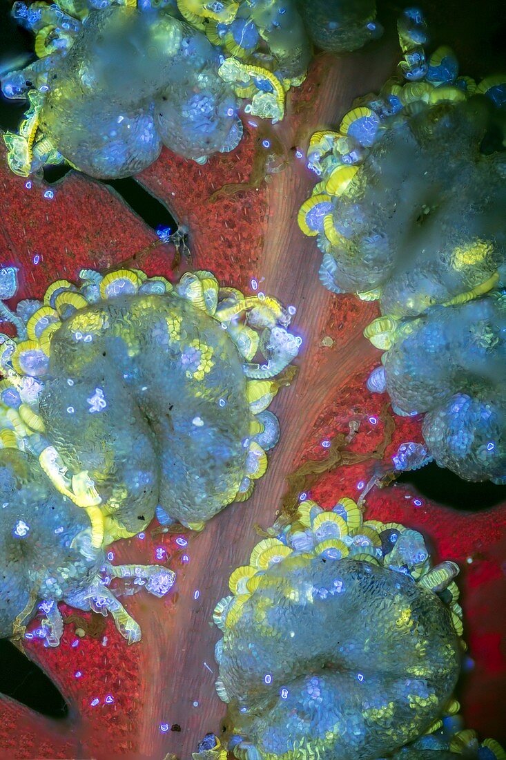 Tree fern spores,light micrograph