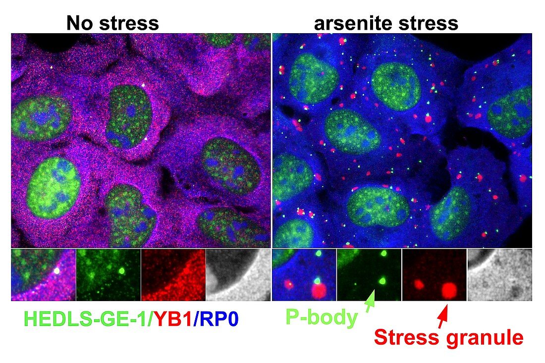 Arsenite-stressed cells,light micrograph