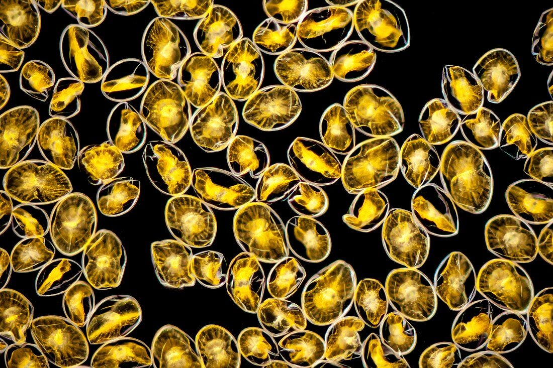 Pyrocystis noctiluca dinoflagellate,LM