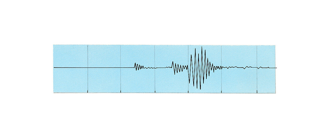 Seismograph trace