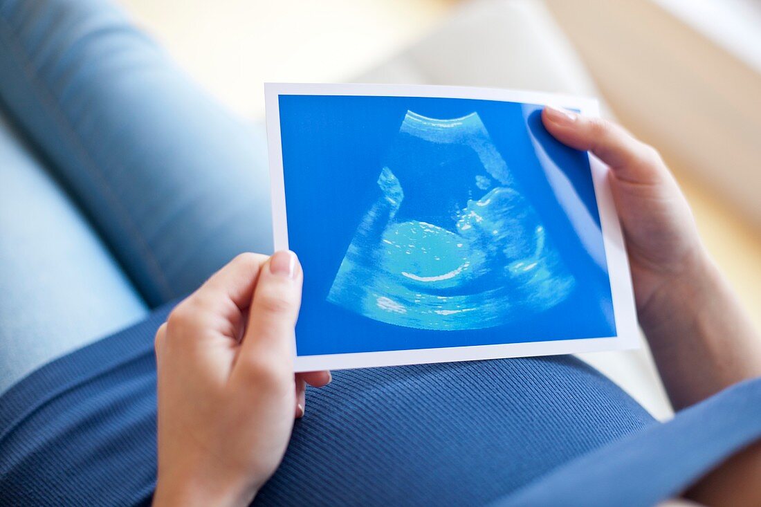 Pregnant woman looking at baby scan