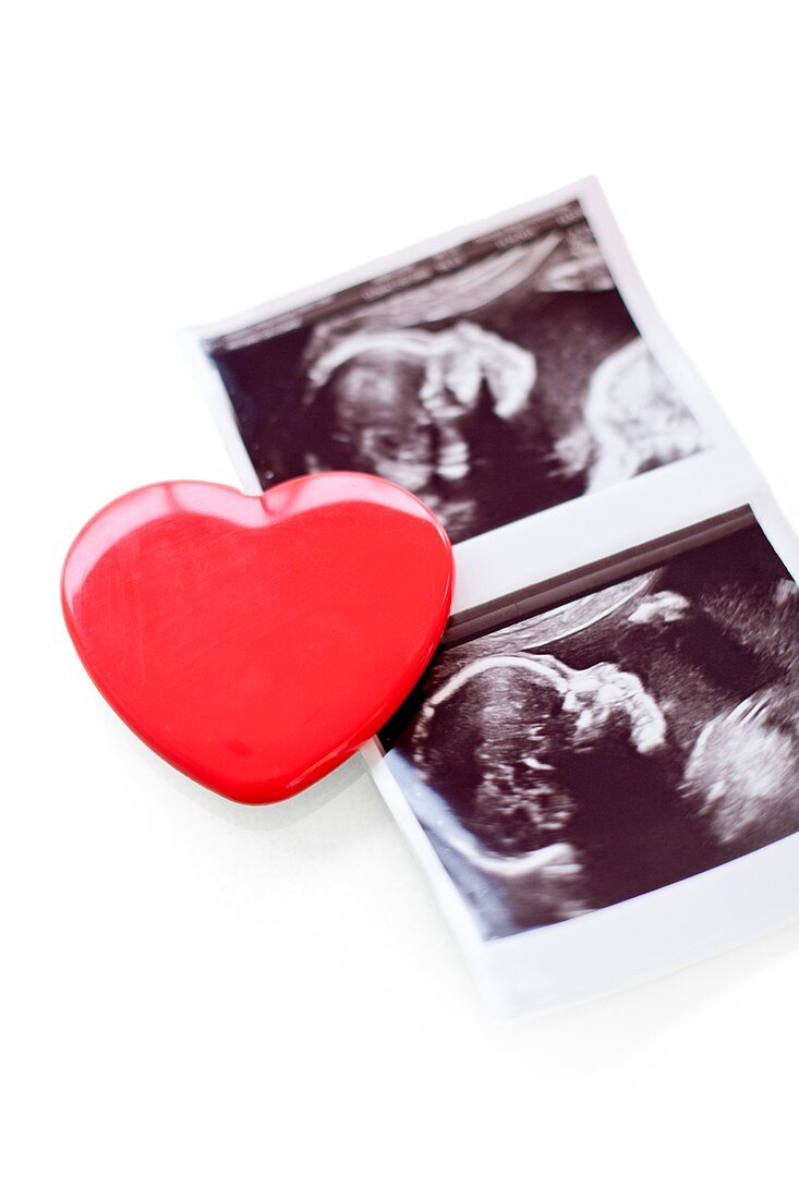 Baby scan photos and red heart
