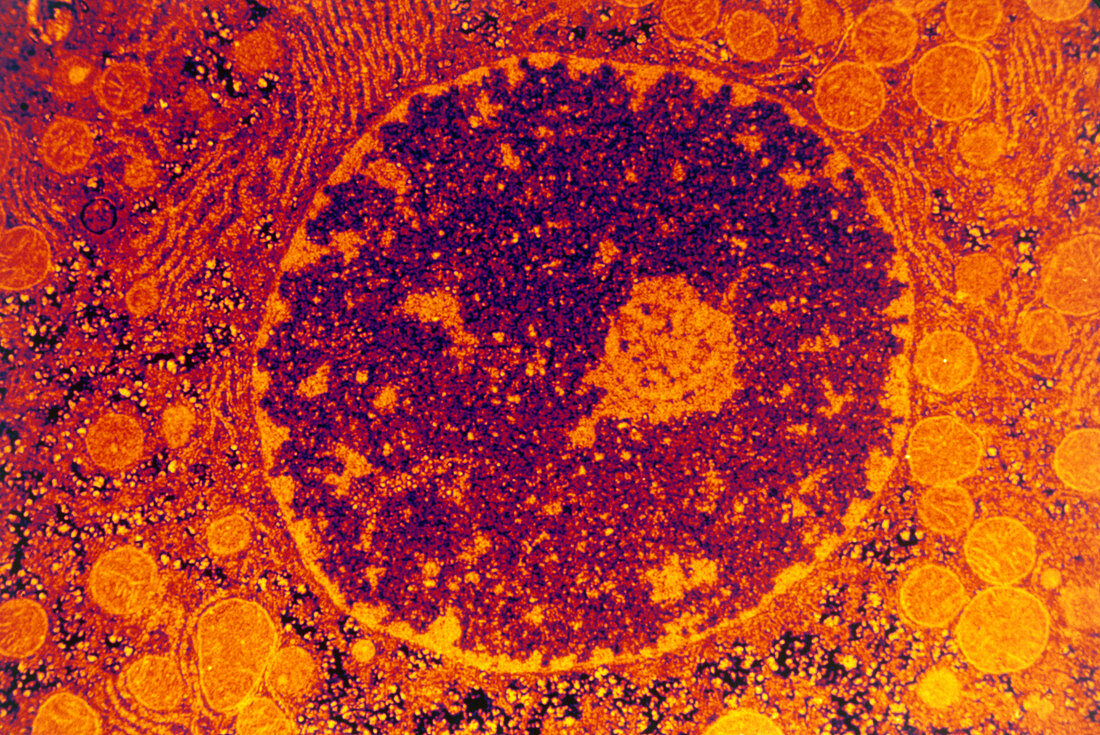 Coloured TEM of liver cell nucleus
