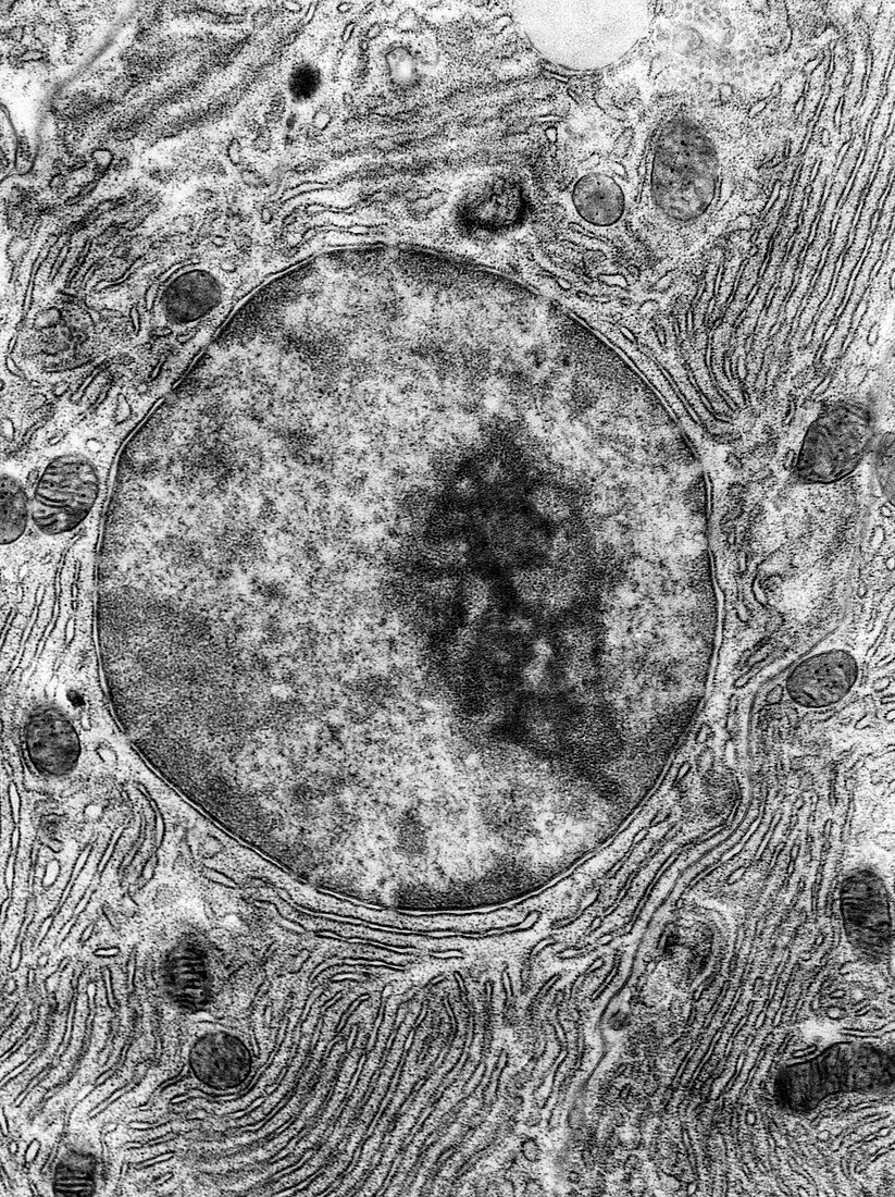 Pancreatic cell nucleus,TEM