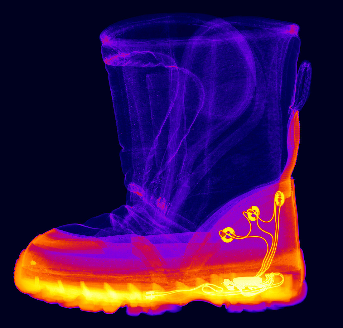 X-ray of a Child's Light-Up Boot