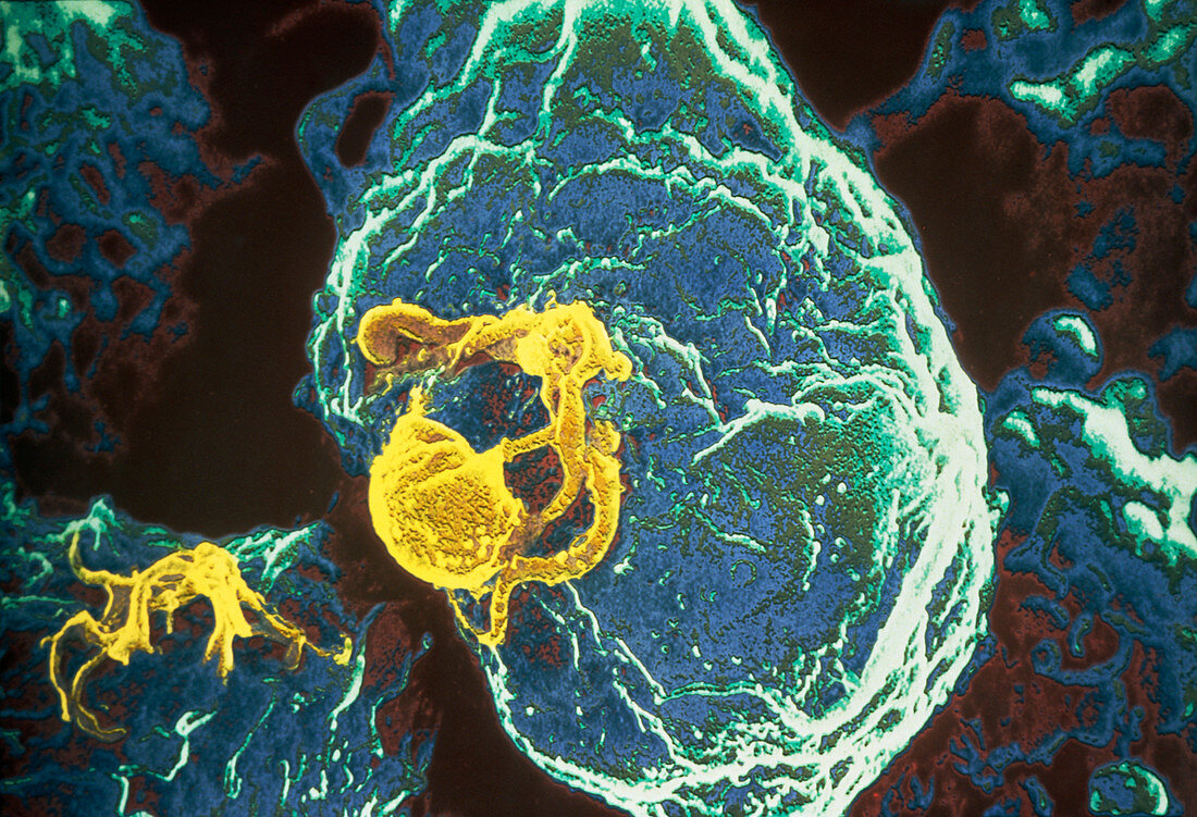Coloured SEM of the AIDS virus infecting a T-cell