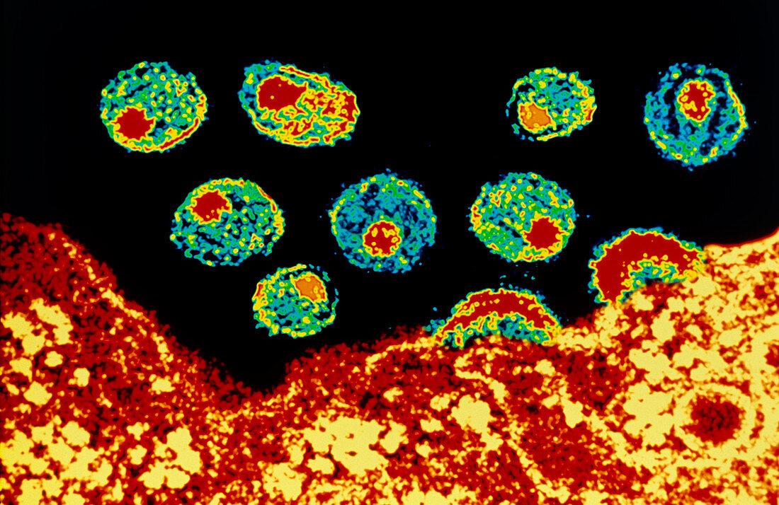 Coloured TEM of HIV viruses budding from a T-cell