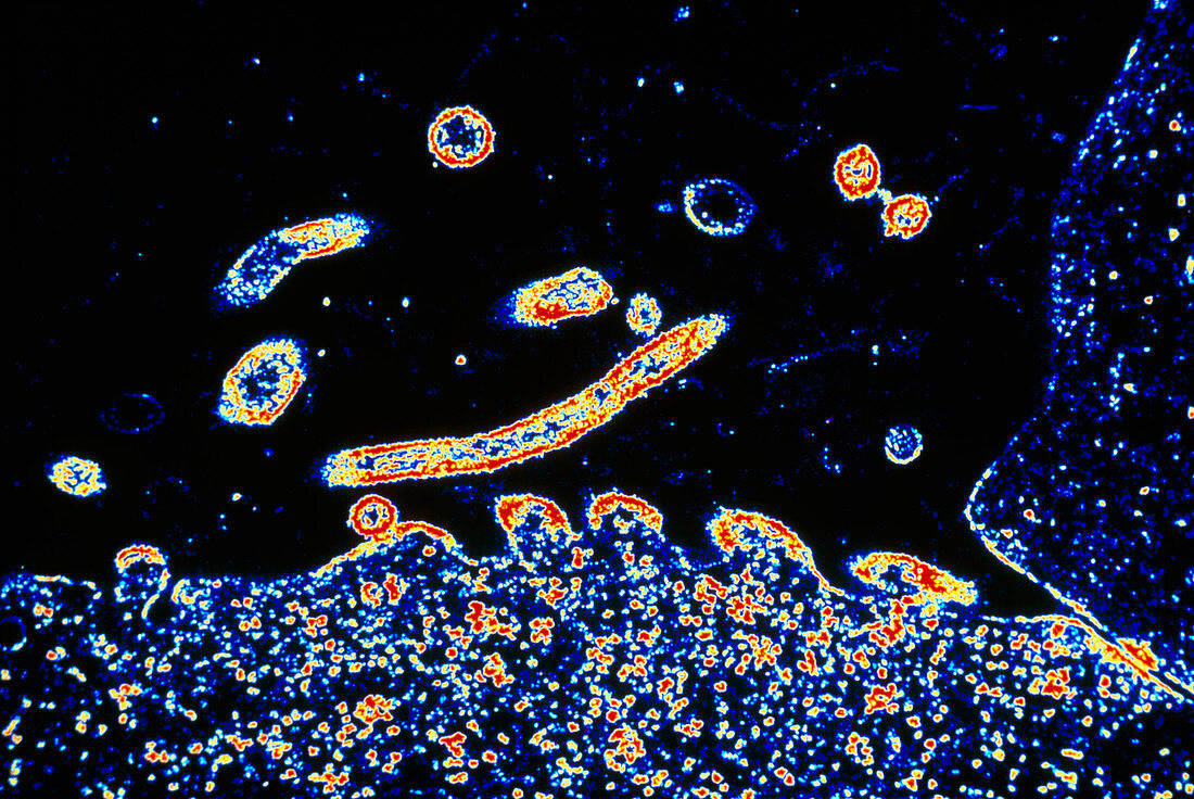 Coloured TEM of respiratory syncytial (RSV) virus