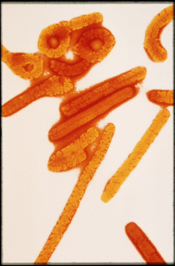 Marburg virus particles,TEM