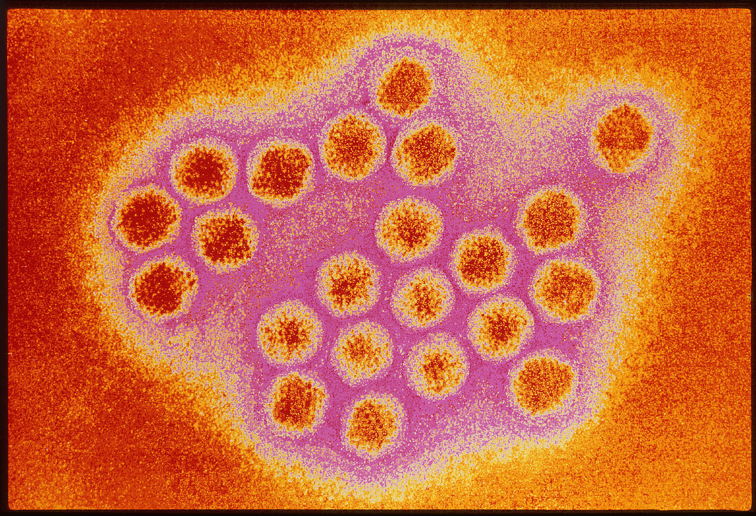 Adenovirus particles