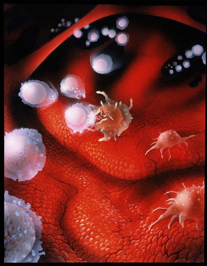 Artwork of lymphocytes attacking cancer cells