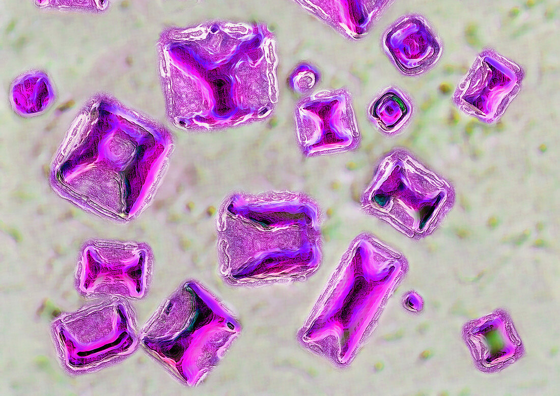 Calcium Oxalate