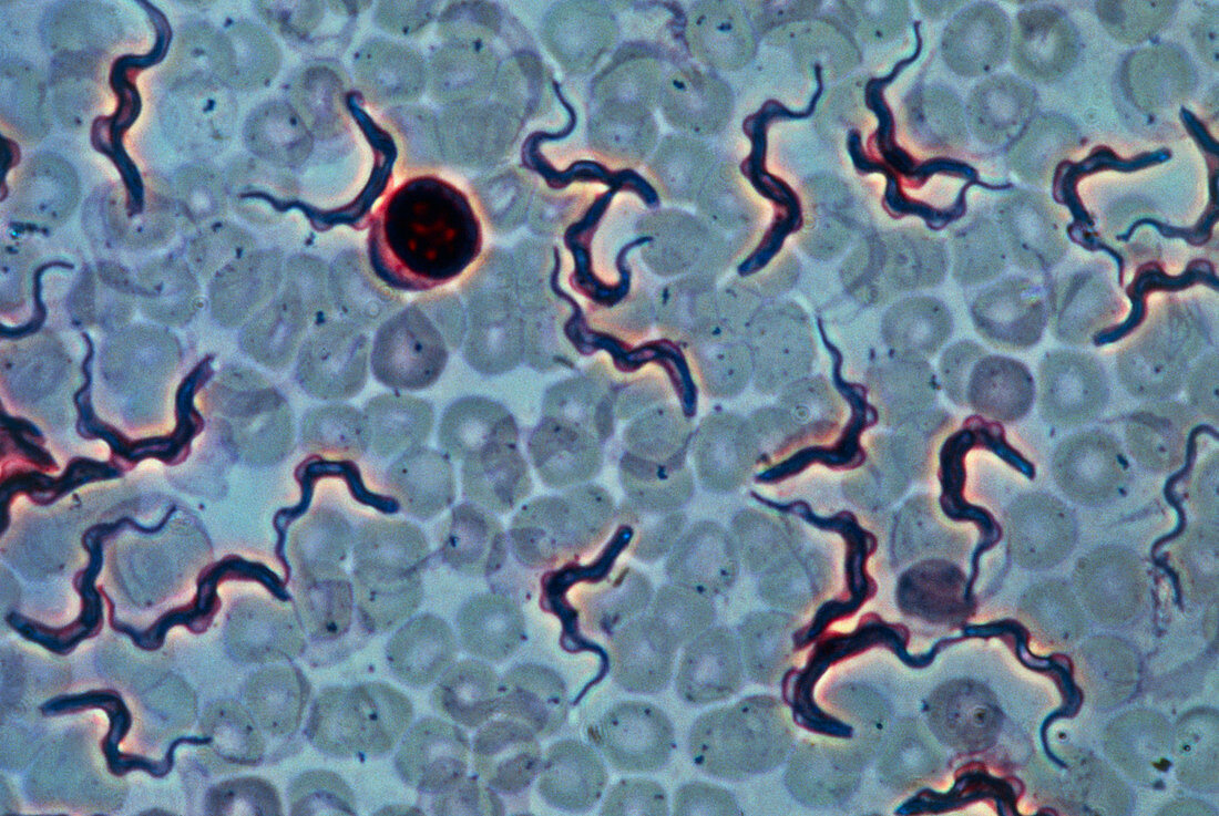 LM of blood infected with parasitic protozoans