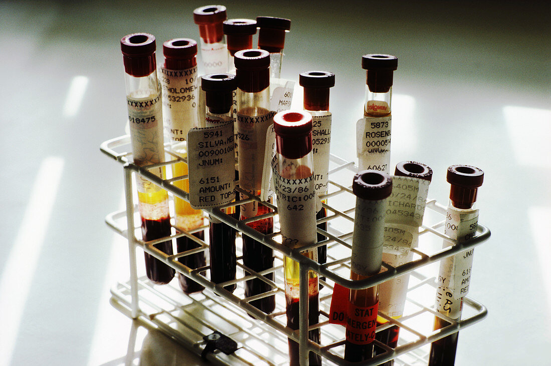 Test Tubes for Blood Tests