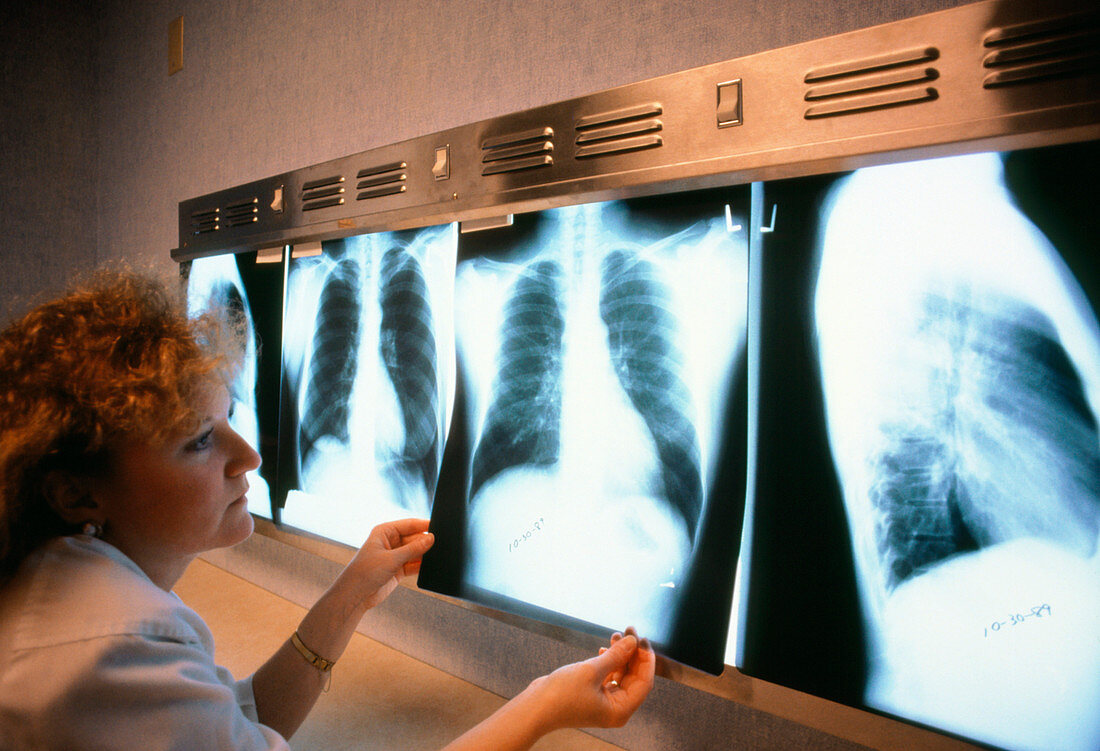Technician displaying X-rays on a light box
