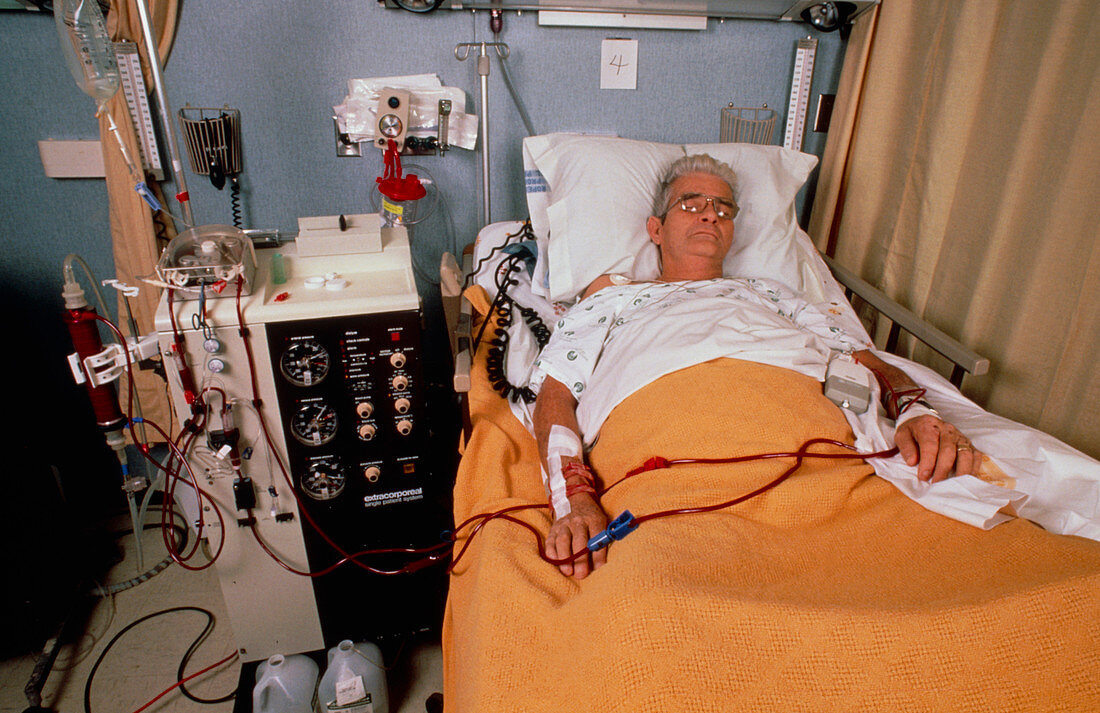 Elderly man undergoing renal dialysis