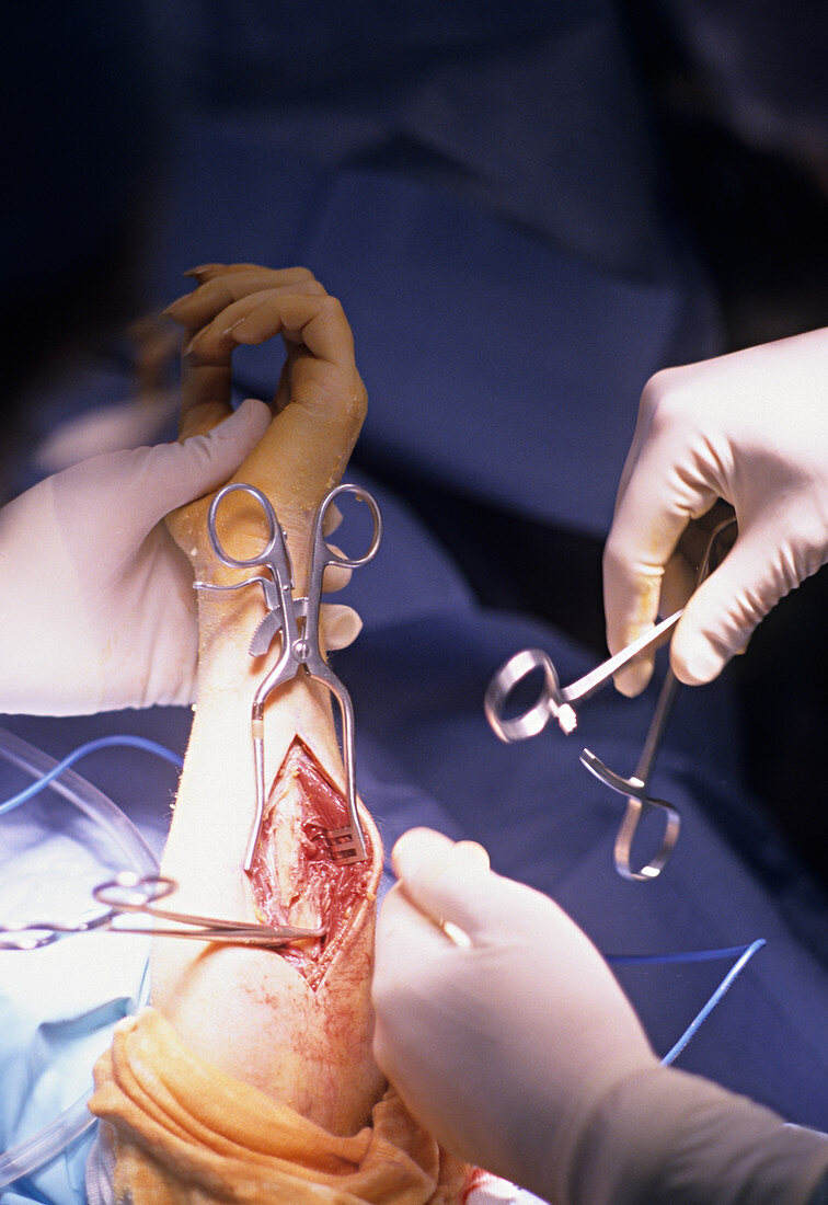 Orthopedic Surgery