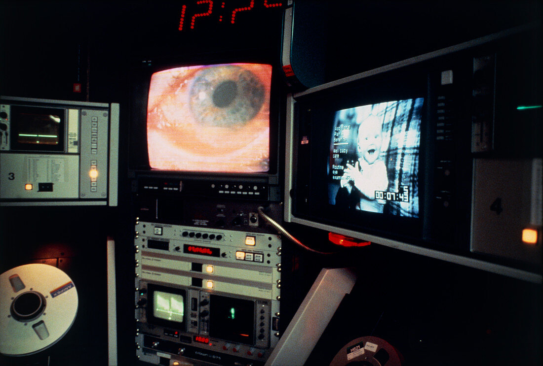 Eye operation shown on tv monitors in op. theatre