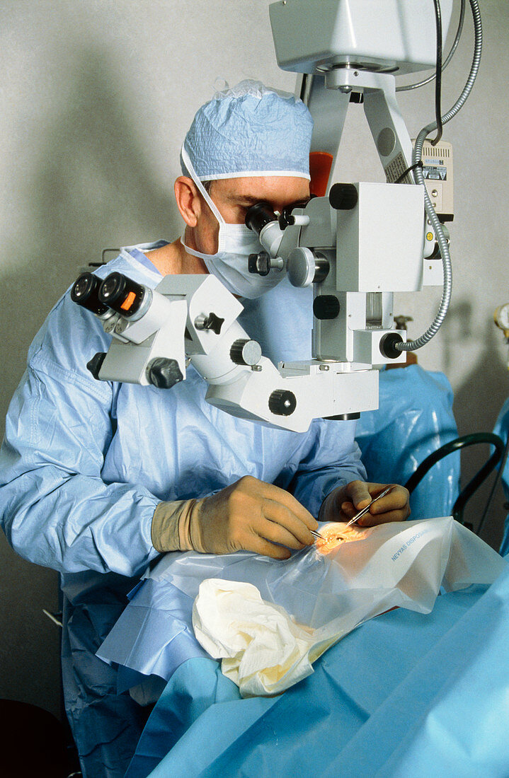 Surgeon doing cataract surgery using microscope