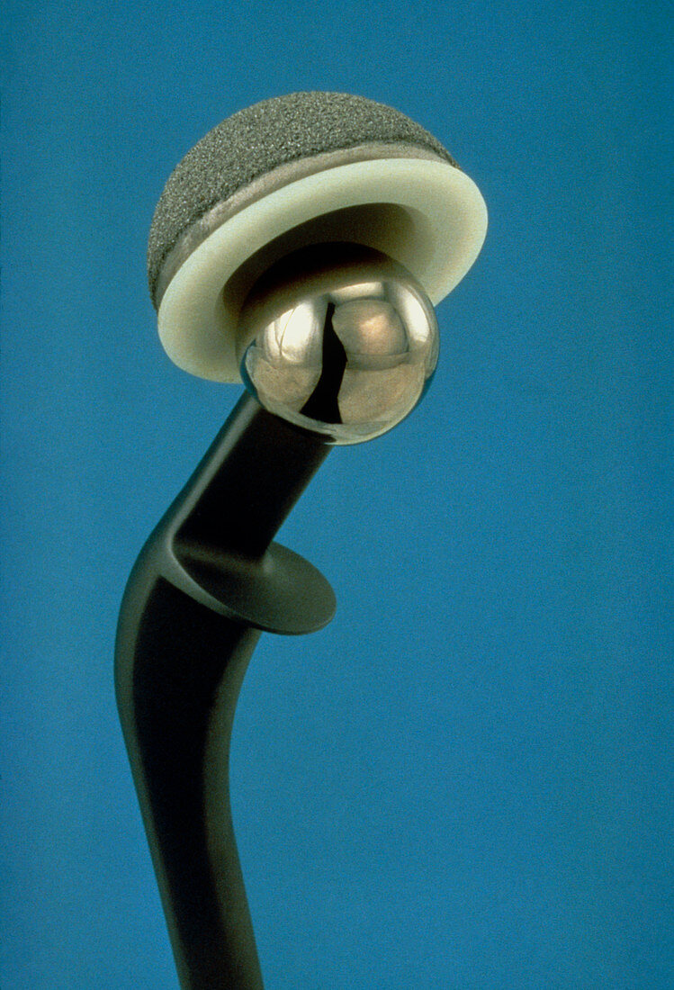 Prosthetic hip (artificial hip joint)