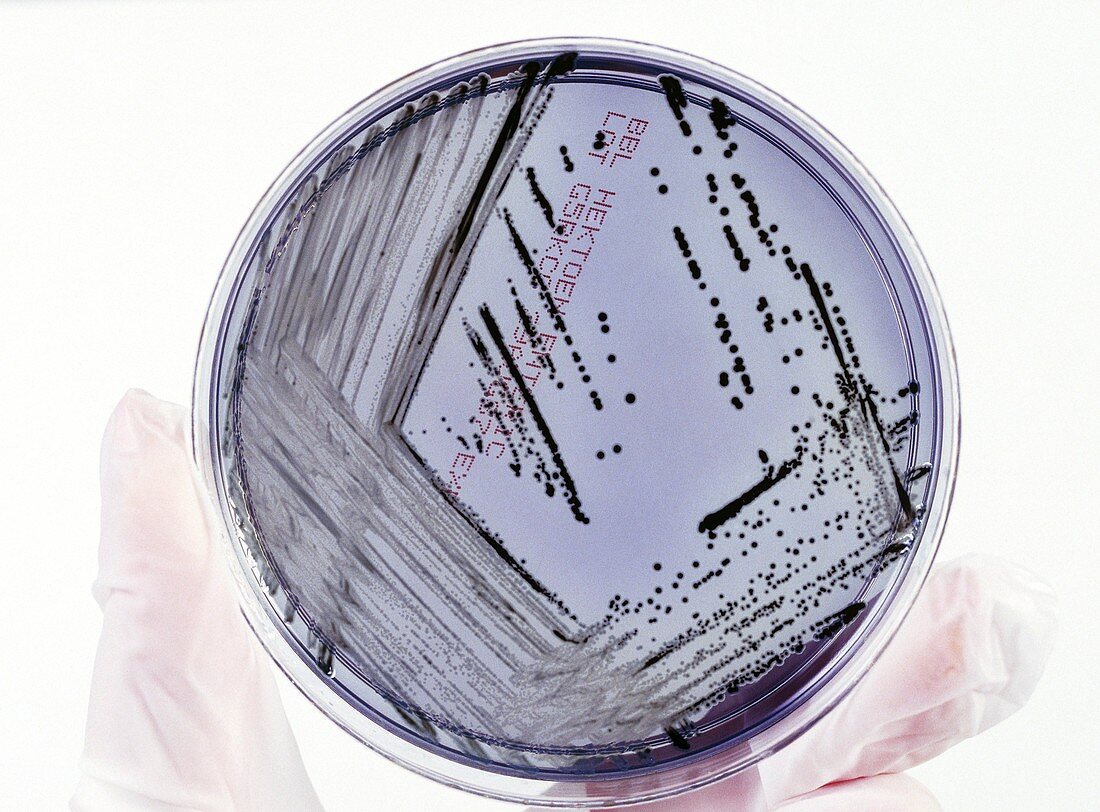 Petri dish culture of Salmonella bacteria