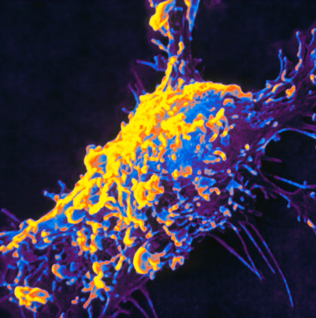 Scanning electron micrograph of endothelial cell