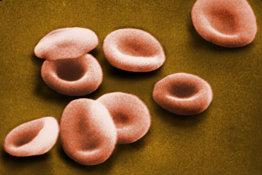 SEM of Red Blood Cells