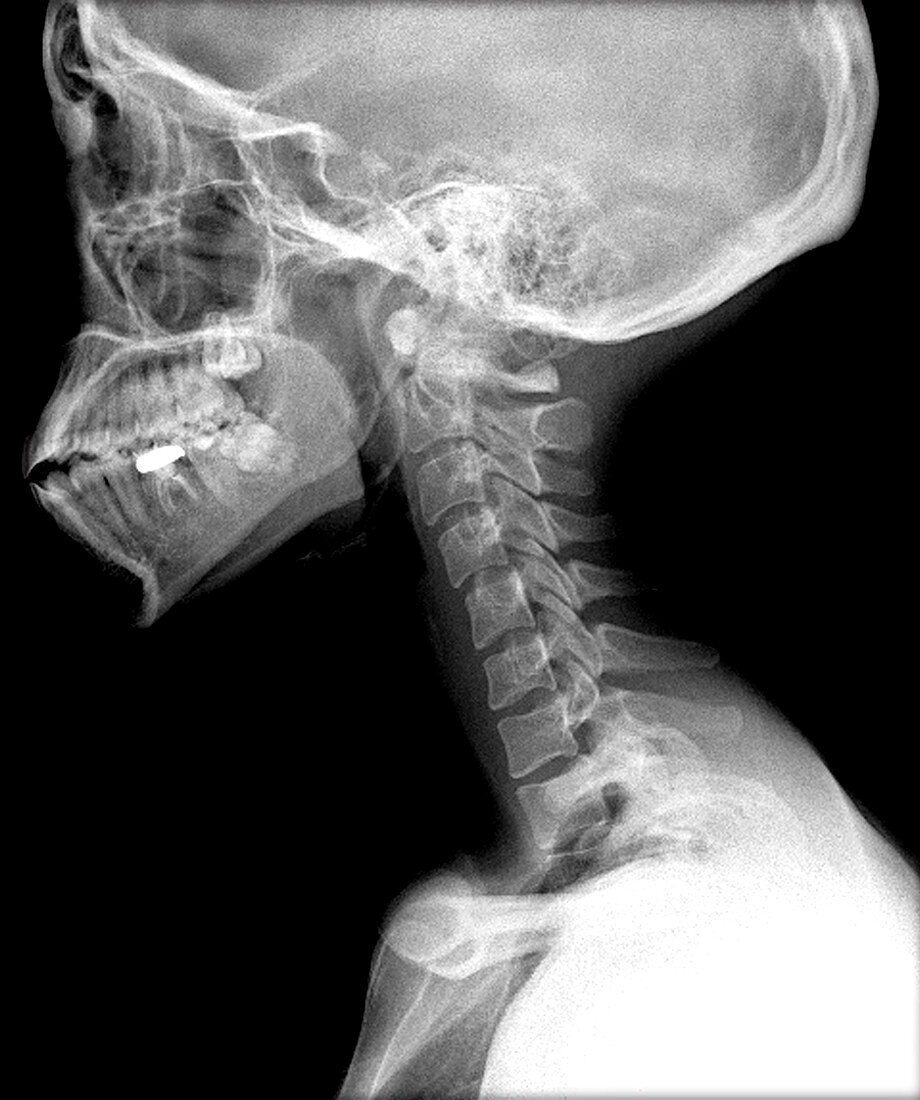 Human Skull and Cervical Spine