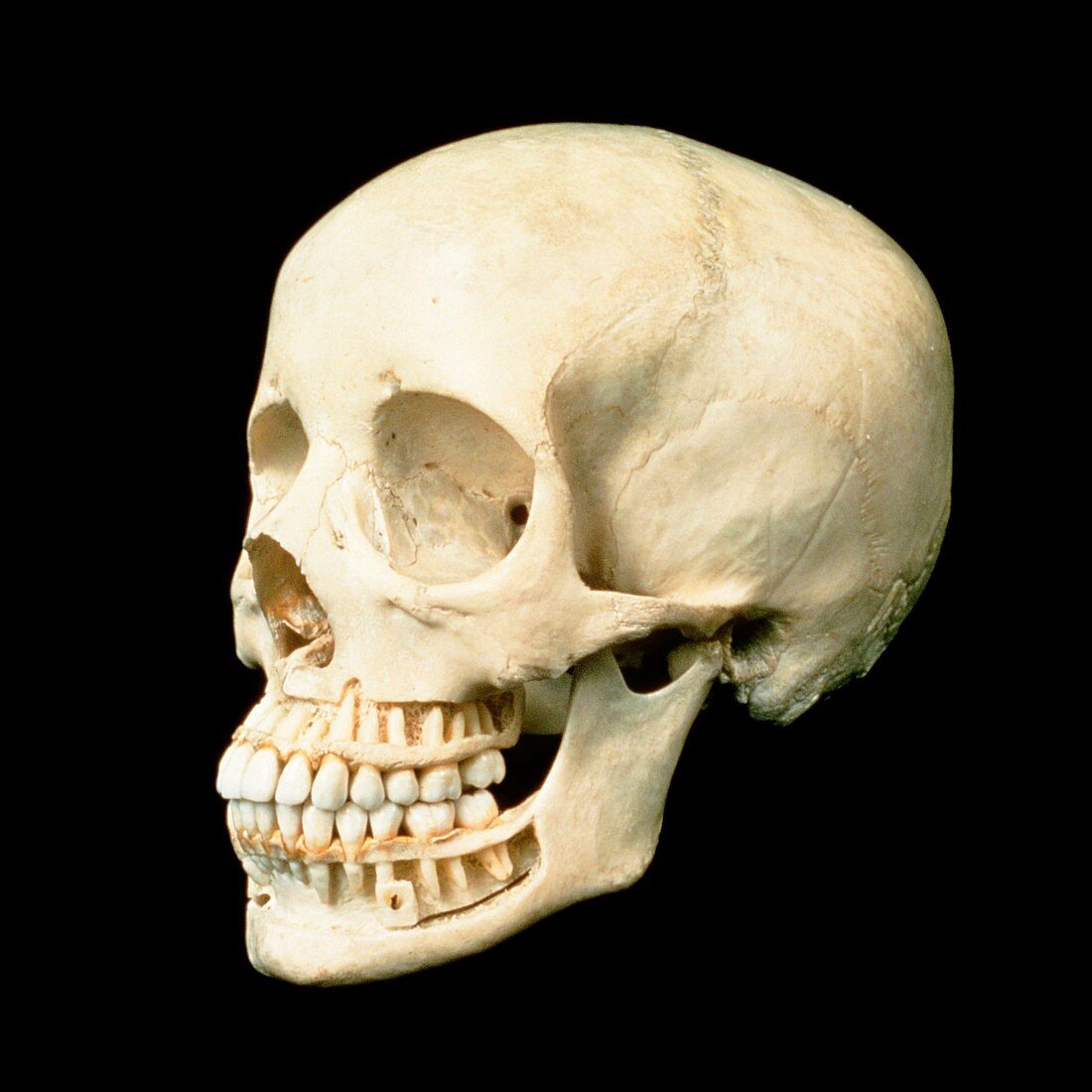Human skull showing roots of teeth