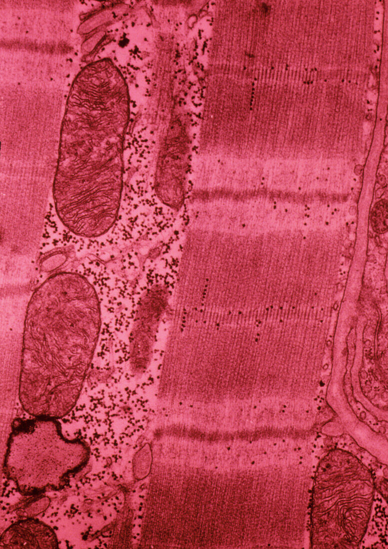 TEM of cardiac muscle cell