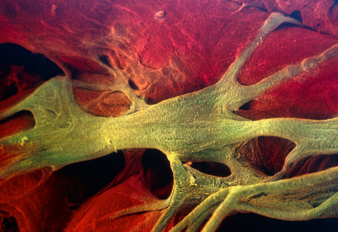 Coloured SEM of Purkinje fibres and heart muscle