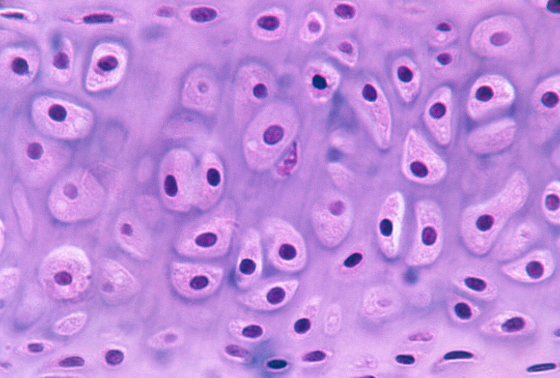 LM of a section through hyaline cartilage