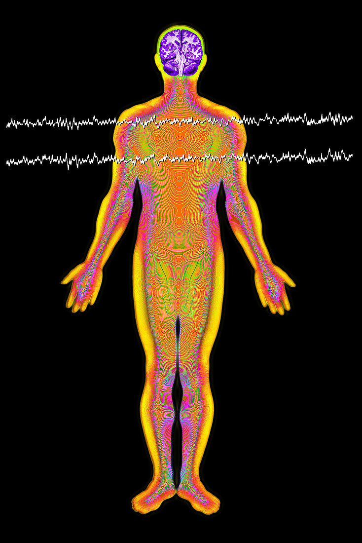 Brainwave illustration