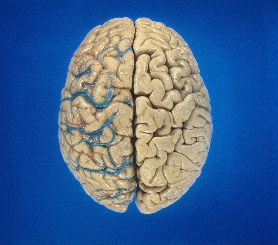 Superior view of brain