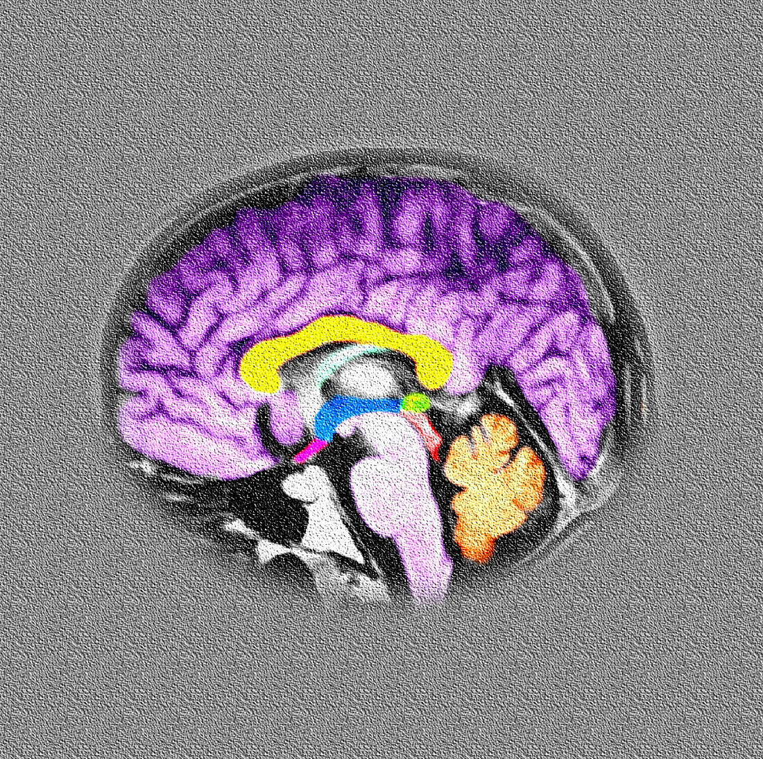 Sagital View of the Normal Human Brain