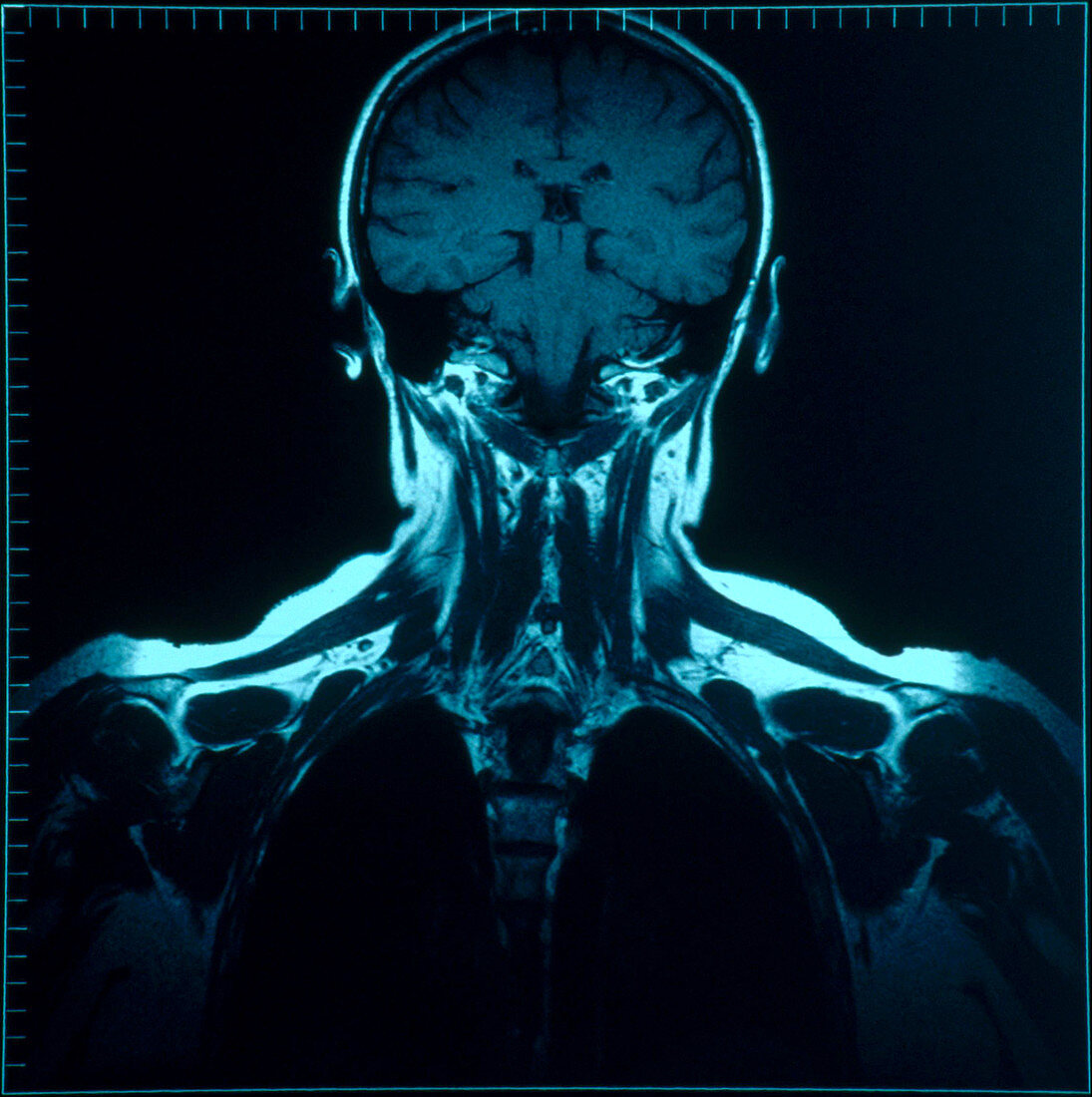 Head and torso MRI