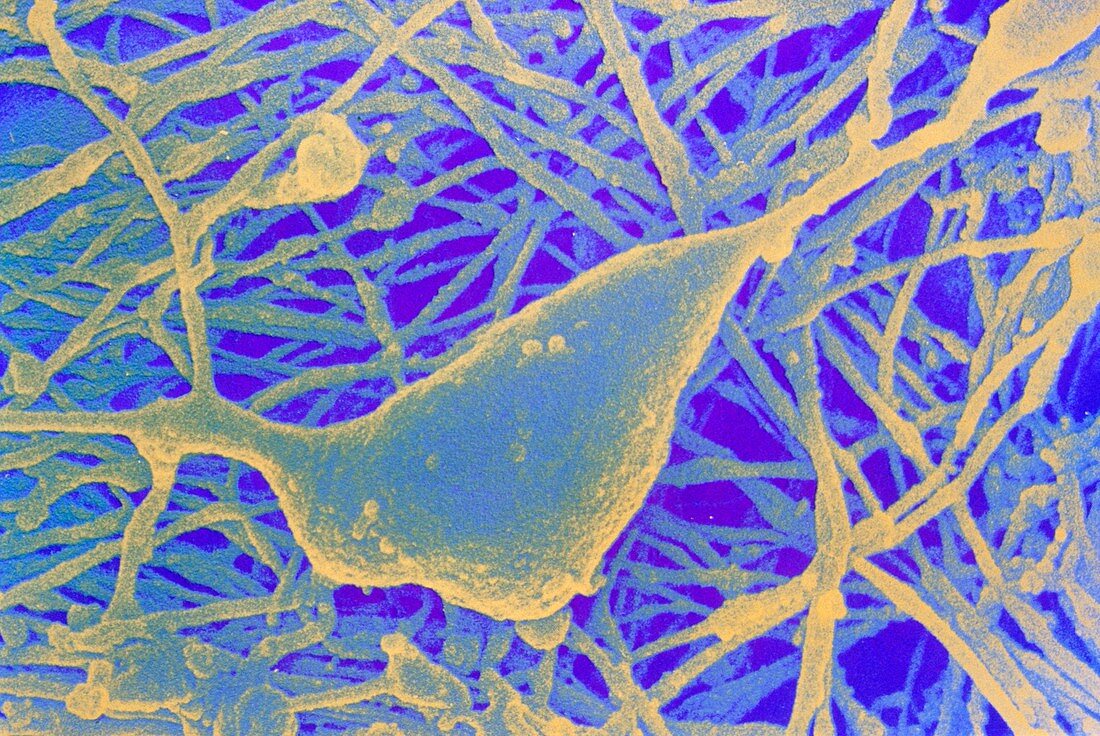 False-colour SEM of human nerve cell in intestine