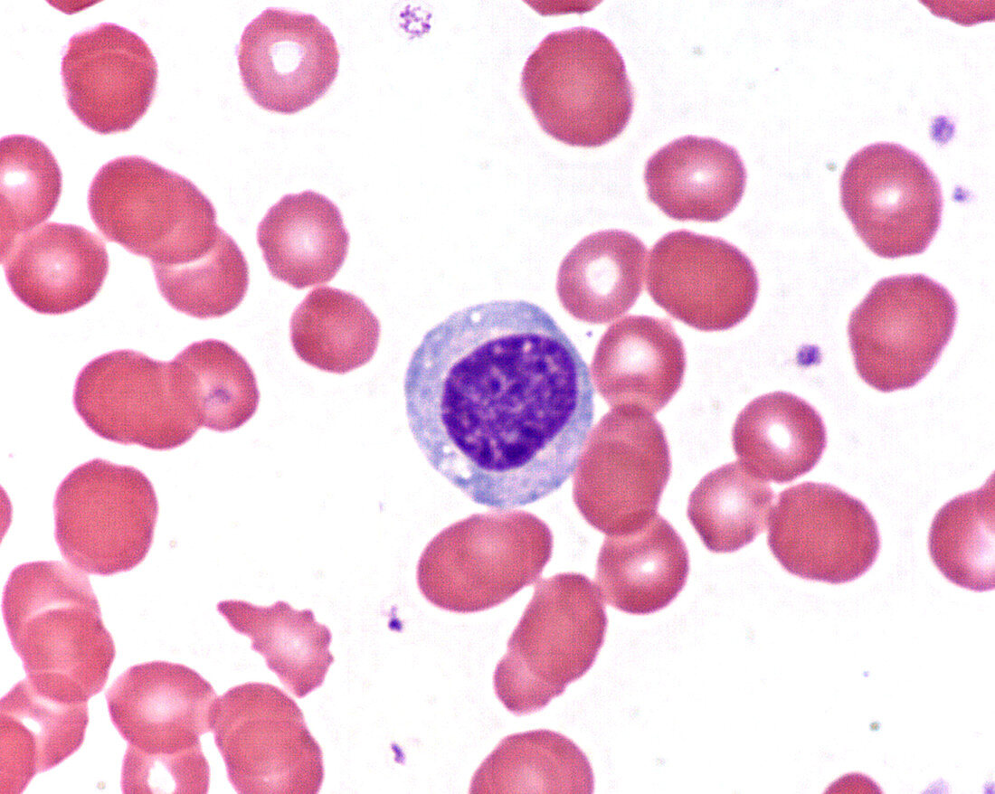 Large lymphocyte