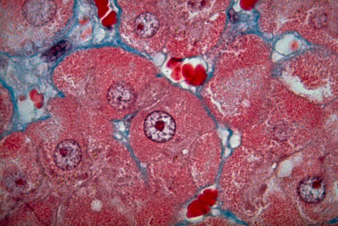LM of human liver tissue showing hepatocytes